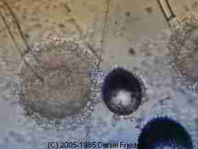 Aspergillis